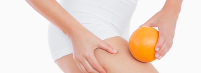 Exercise and Cellulite